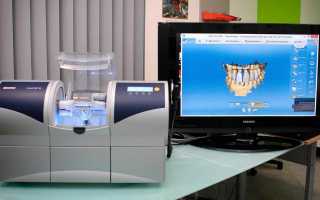 CAD/CAM системы в стоматологии