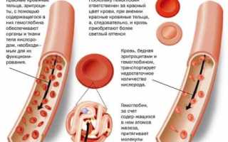 Симптомы и лечение анемии, причины, профилактика заболевания